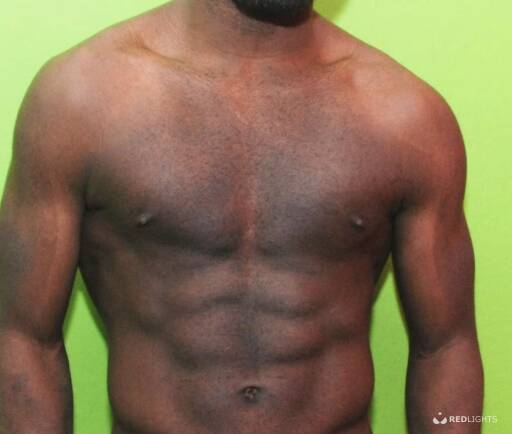 Blackson (Foto)